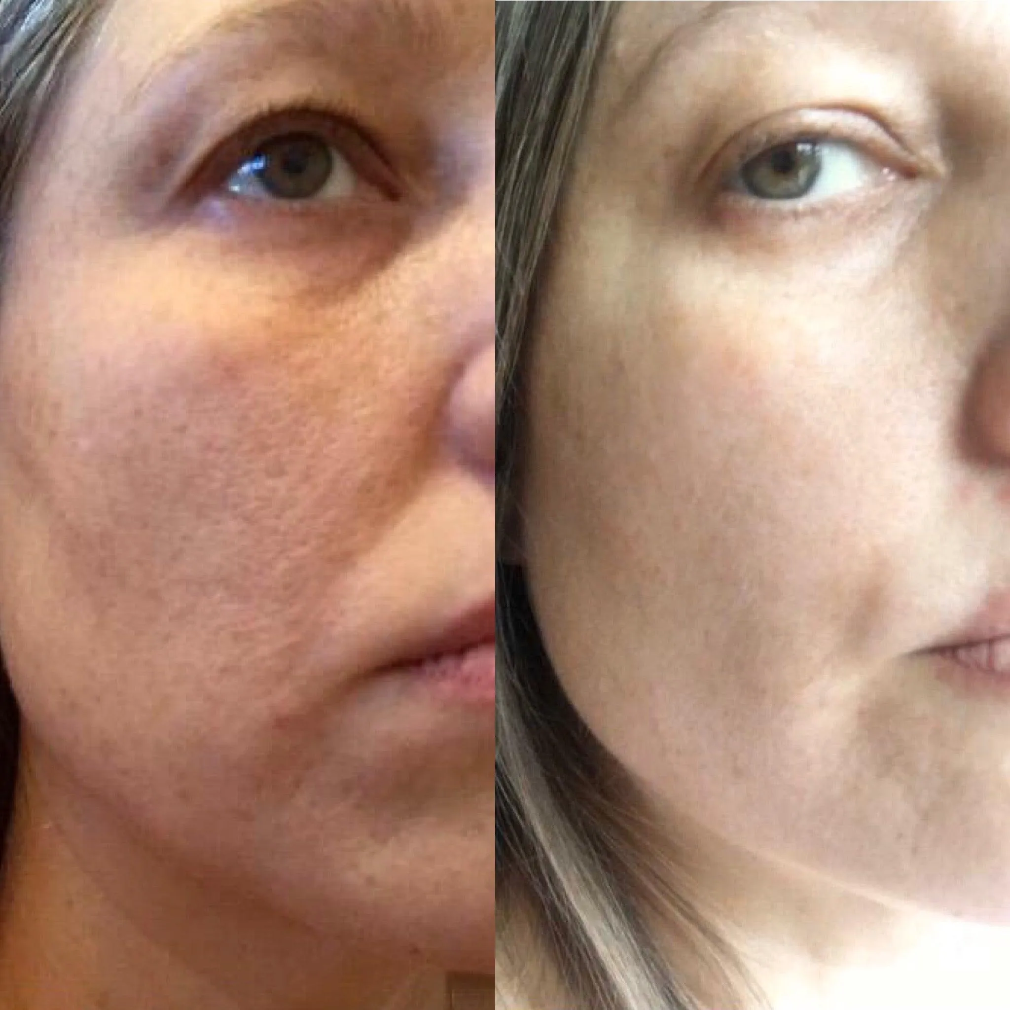 Douvall's Skin-High Wrinkle Rehab Serum