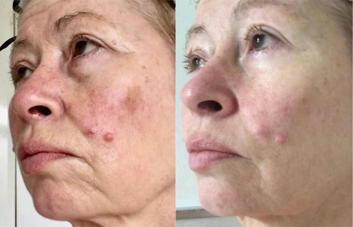 Douvall's Skin-High Wrinkle Rehab Serum